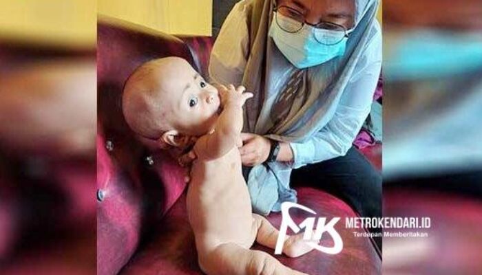 Dua Bayi Penderita Gizi Buruk di Konkep Kondisinya Memperihatinkan