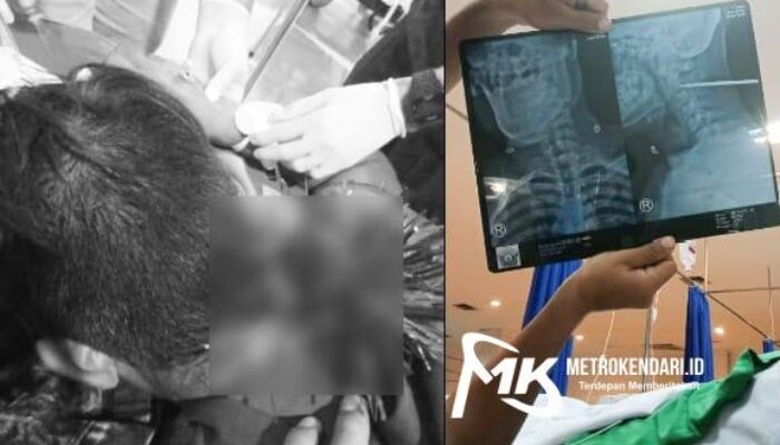 Seorang Warga Dibusur OTK Saat Hendak Cari Makan di Kendari Beach